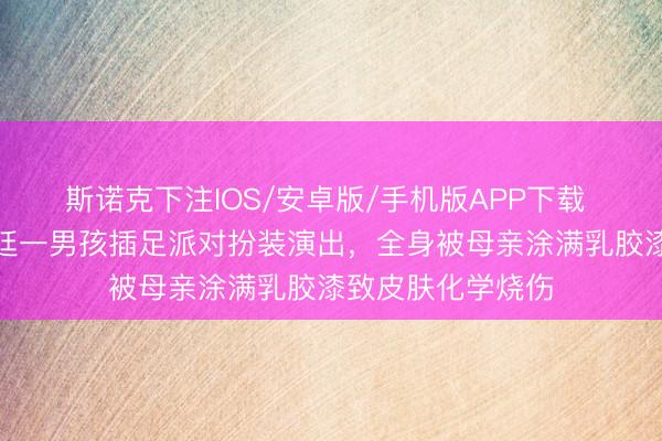 斯诺克下注IOS/安卓版/手机版APP下载 洗不掉了！阿根廷一男孩插足派对扮装演出，全身被母亲涂满乳胶漆致皮肤化学烧伤